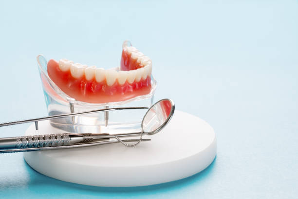 Dental Inlays and Onlays in Setauket, NY